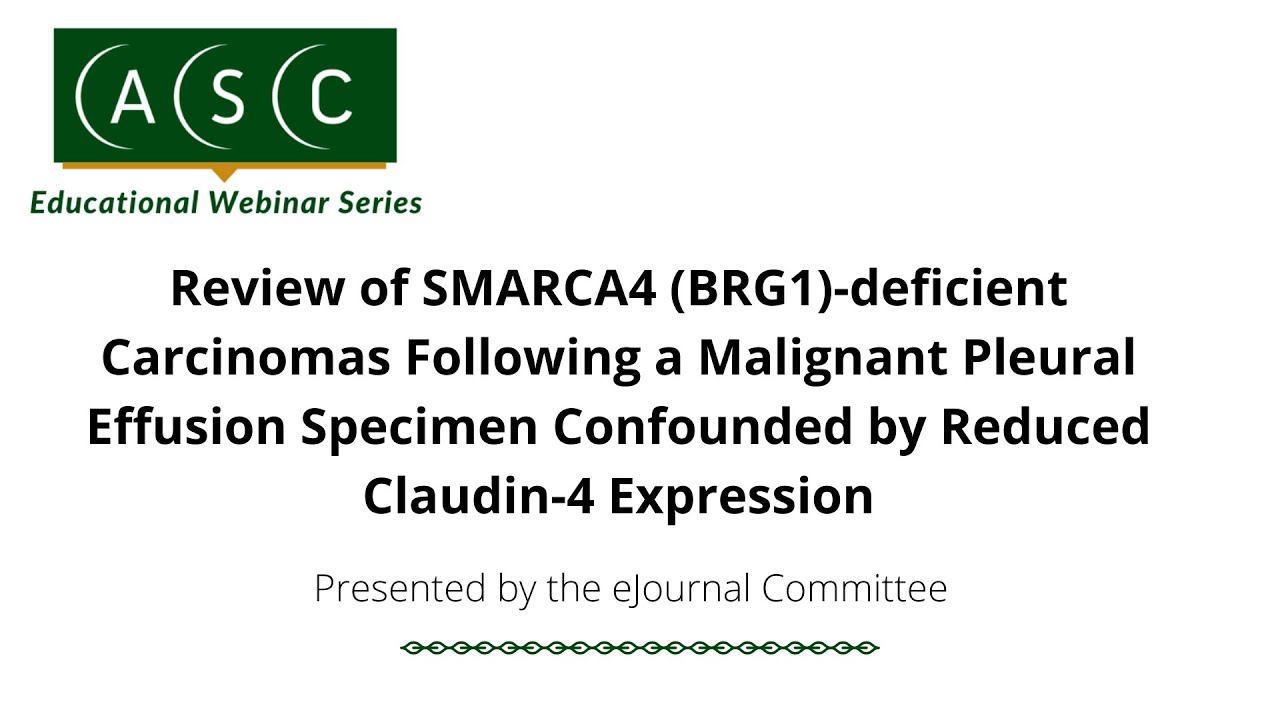 Review of SMARCA4 (BRG1)-deficient Carcinomas Following a Malignant Pleural Effusion Specimen...