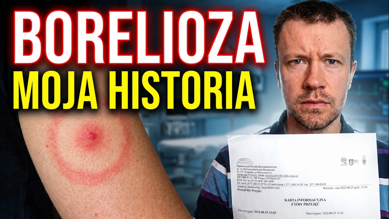Miałem boreliozę. Tak ją rozpoznano i leczono