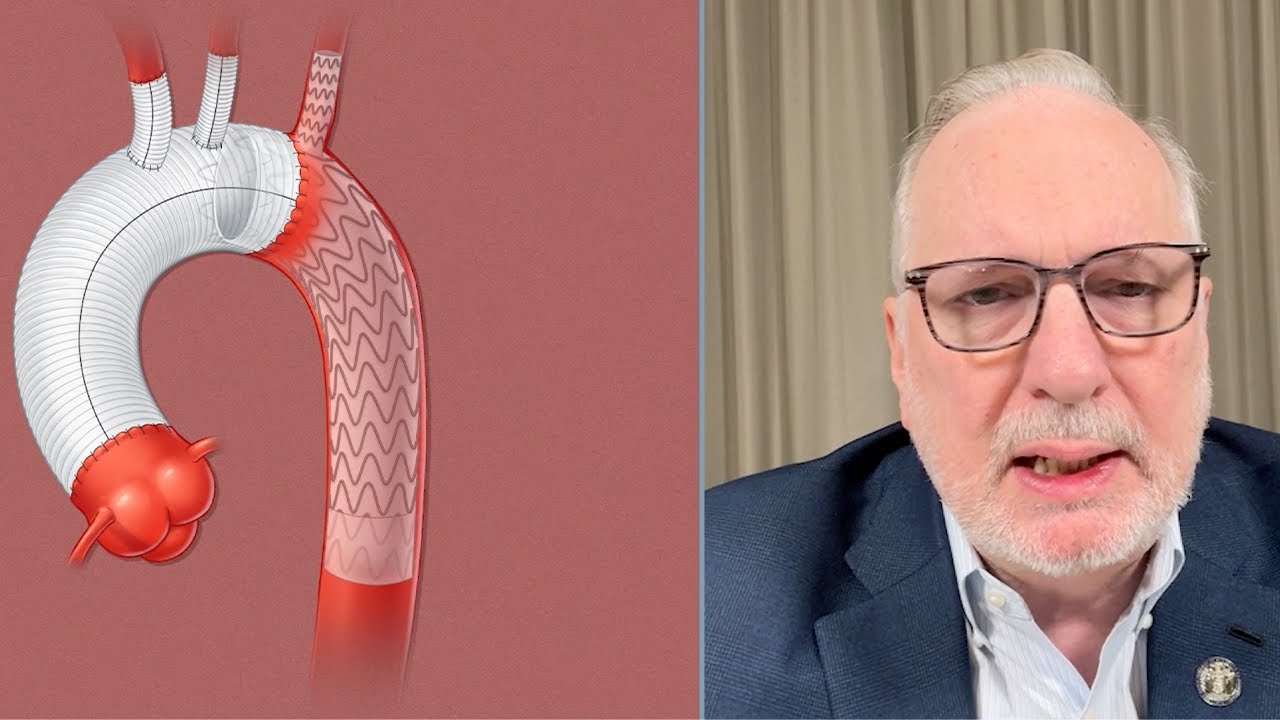 Staged open and TEVAR approach with TBE offers “complete and total thoracic solution” in multiple...