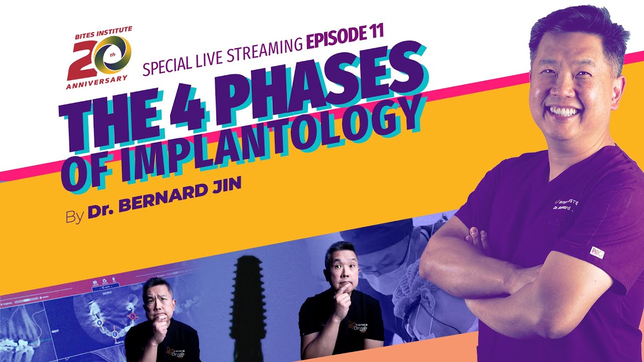 THE 4 PHASES OF IMPLANTOLOGY