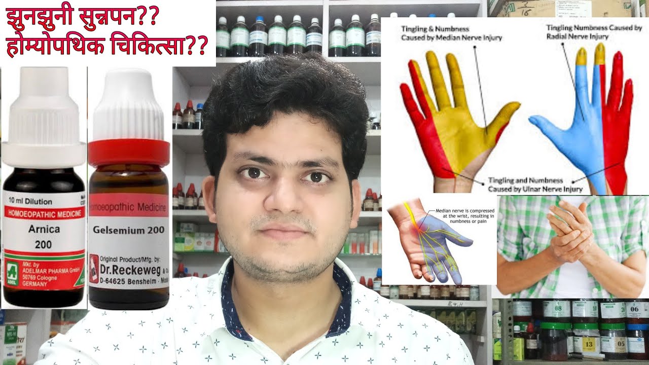 Numbness tingling! Homeopathic medicine for Numbness?? explain?