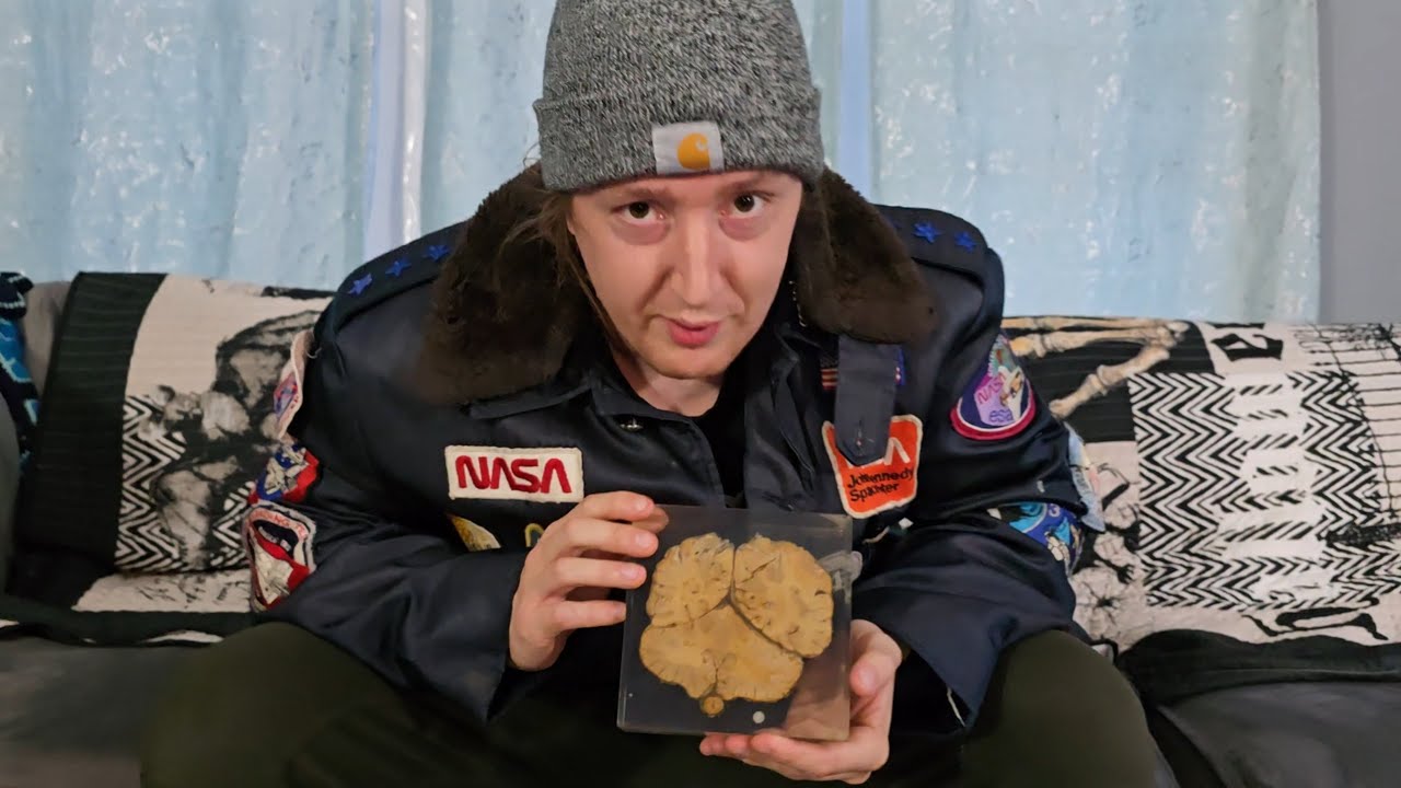 ПОКУПКА ЧЕЛОВЕЧЕСКОГО МОЗГА НА РАСПРОДАЖЕ ИМУЩЕСТВА!