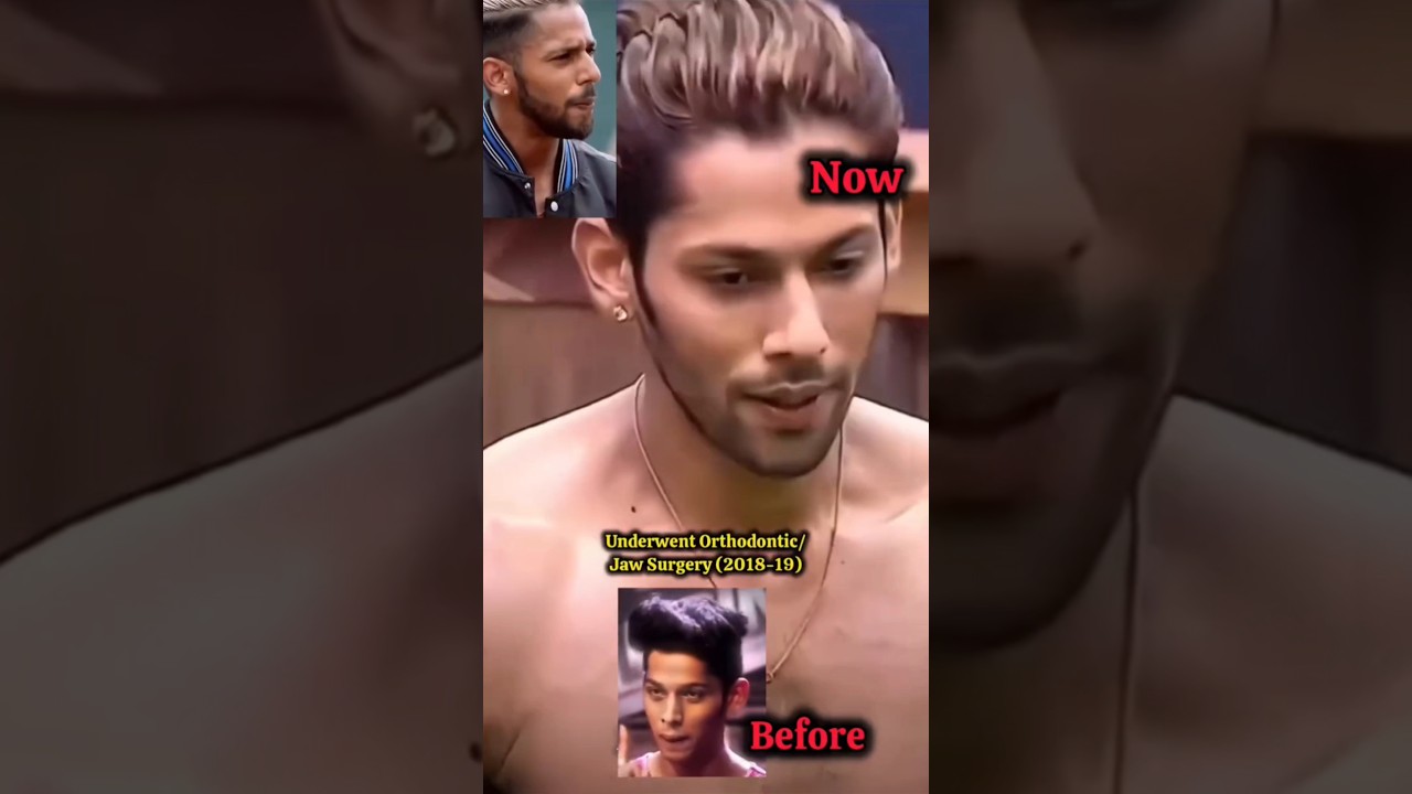 Baseer ali smile makeover #baseerali #bigboss19 #smile