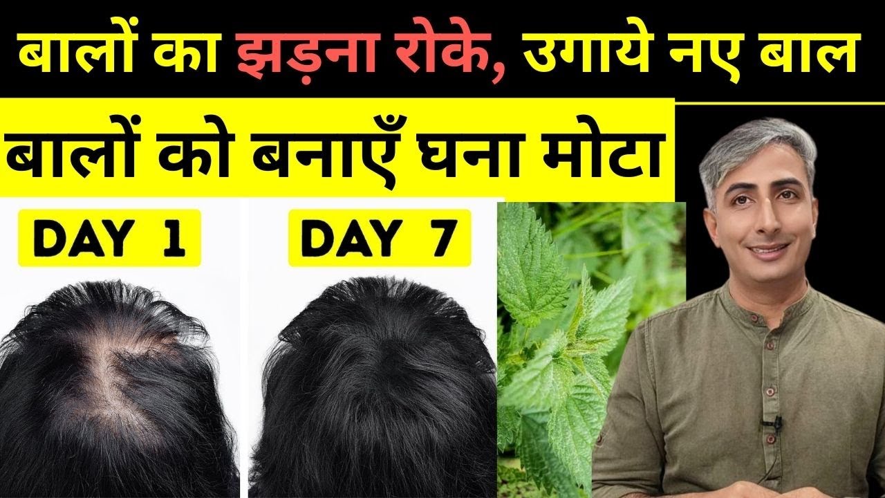 बालों का झड़ना रोके I बनाएँ घना मोटा I उगाये नए बाल | EXTREME HAIR GROWTH FORMULA I DR. MANOJ DAS