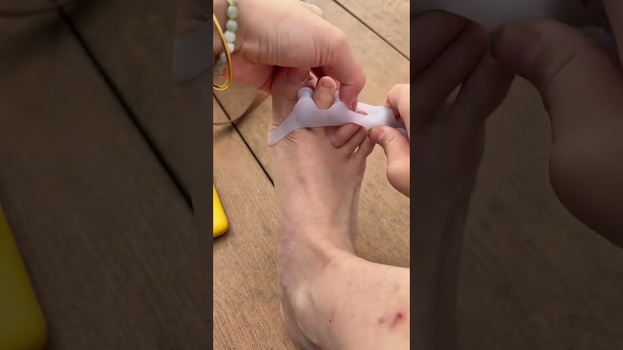 Gel Toe Separator 👣✨ Relieves Foot Pain, Aligns Toes, Comfort All Day 💖🦶