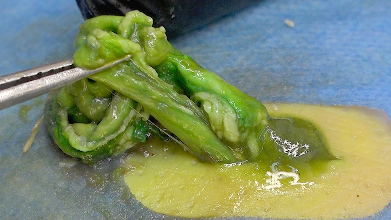 Dr. Lee Geoff Butler Enilsa MrPopZit 😲 Professional pedicure process【Xue Yidao】161202