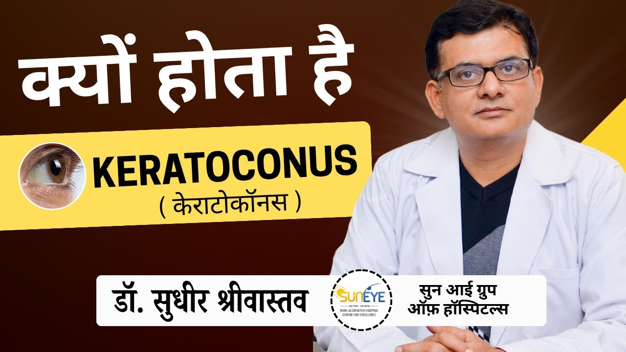 Reasons behind keratoconus development I Keratoconus causes #keratoconus #suneyecafe #eyecare