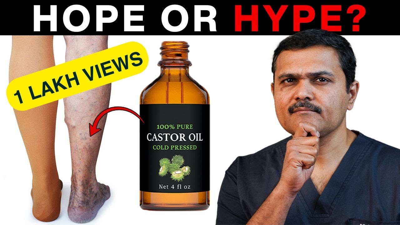 CASTOR OIL for Varicose Veins? All you wanted to know!