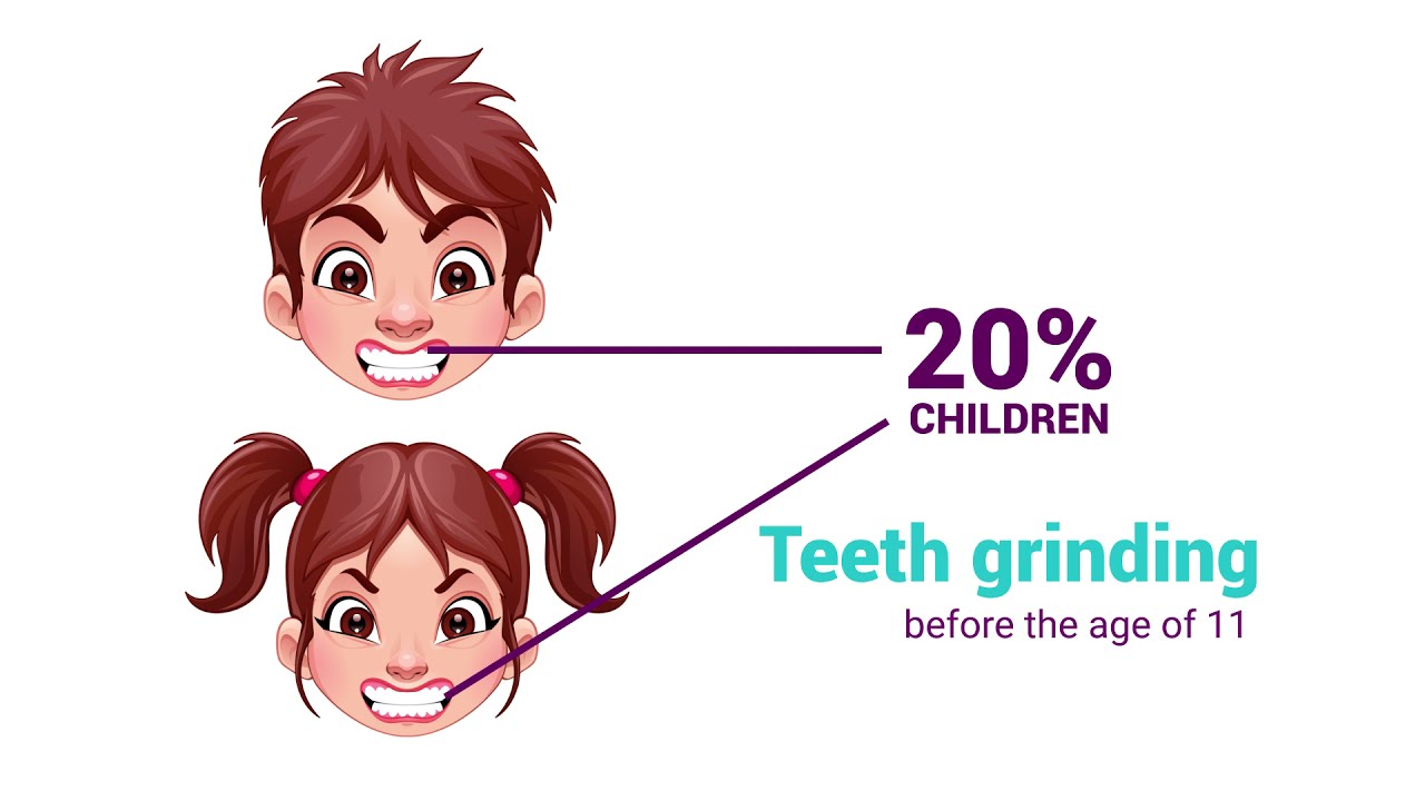 What is Bruxism in Children and How To Treat It - Dr Silman Smile Spa