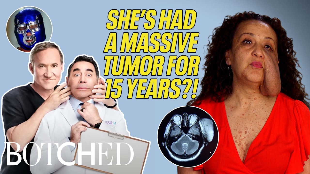 Yamile Has Had A 2-Pound Tumor On Her FACE For 15 Years?! (Before & After) | Botched | E!
