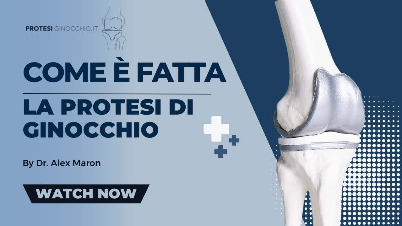 Come è fatta la Protesi di Ginocchio