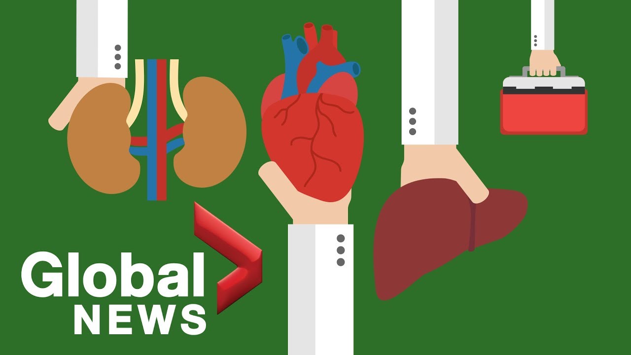 Why Canada struggles to perform just 600 organ donations per year
