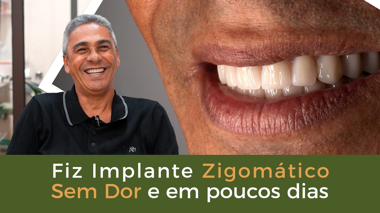 Fiz Implante Zigomático Sem Dor e em Poucos Dias! - Implace Implantes
