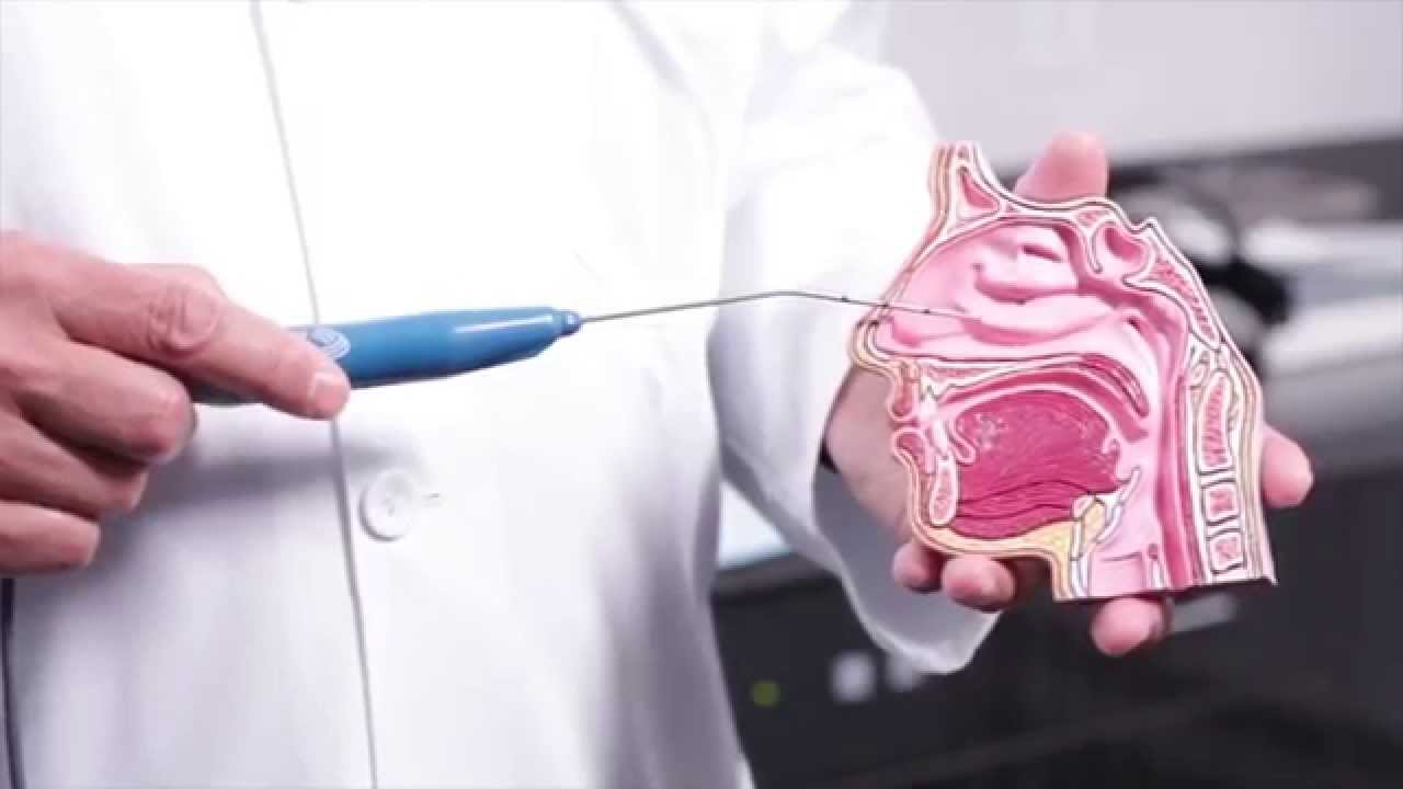 Nasal Turbinate Reduction with Coblation Technology | Non-Invasive Nasal Treatment