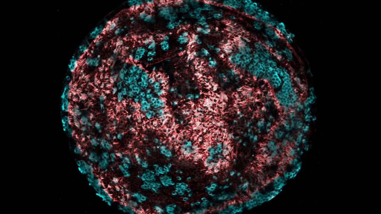 Trial to Reverse Deafness To Begin in 2019 - Frequency Therapeutics
