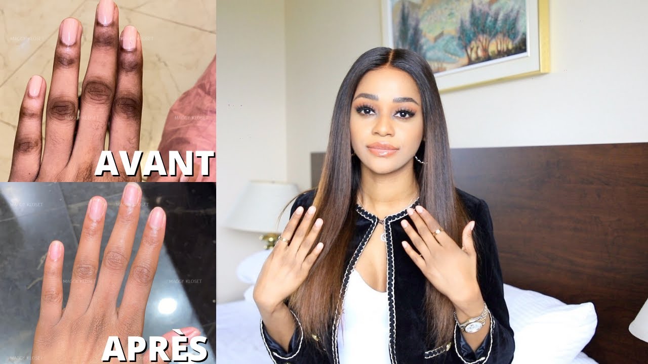 LA SOLUTION CONTRE LES QUINTOS, PIEDS, COUDES ET GENOUX FONC&Eacute;S -  HYPERPIGMENTATION⎮Maggy Kloset