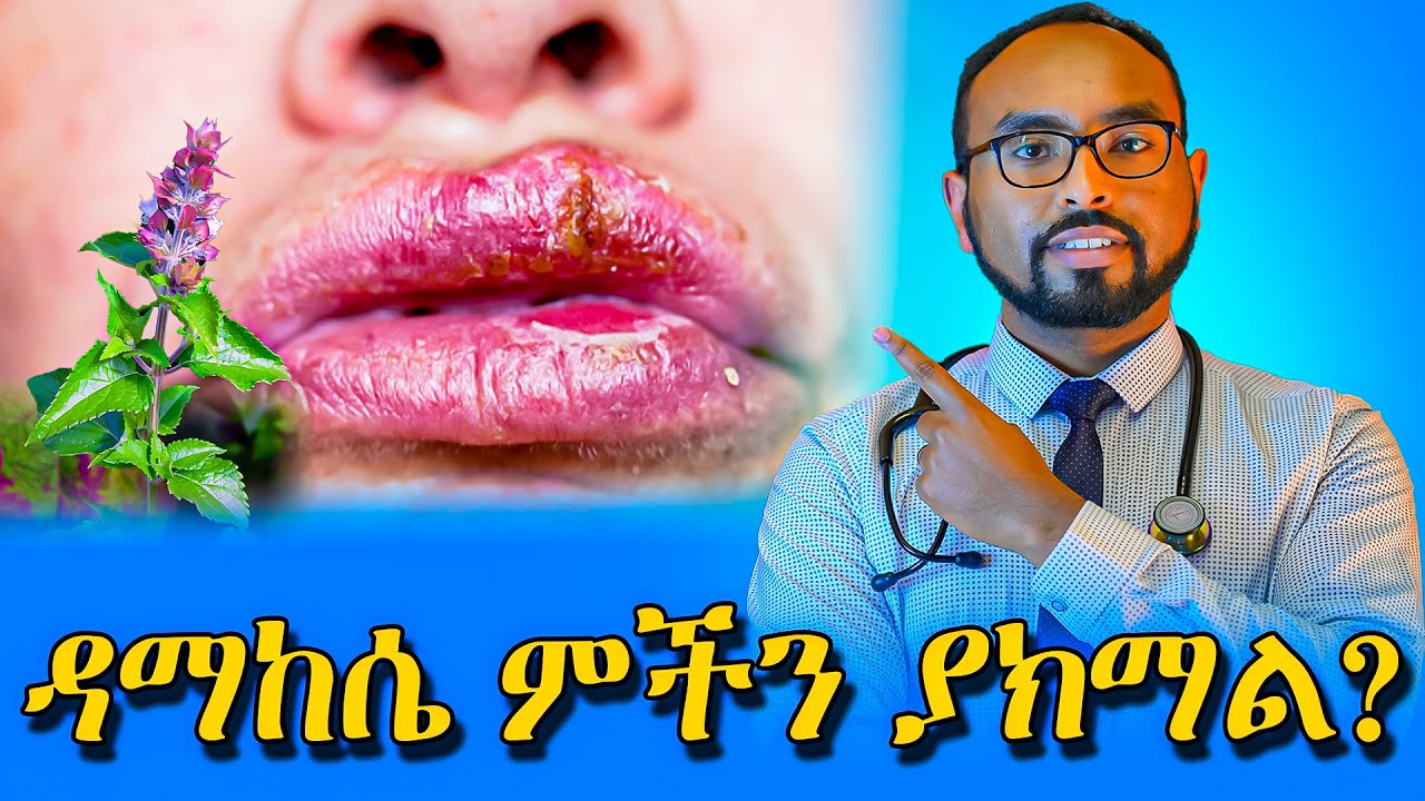የከንፈር እና የብልት ምች ምክንያት ምንድነው❓/ What is the cause of lip and genital herpes / dr. fasil