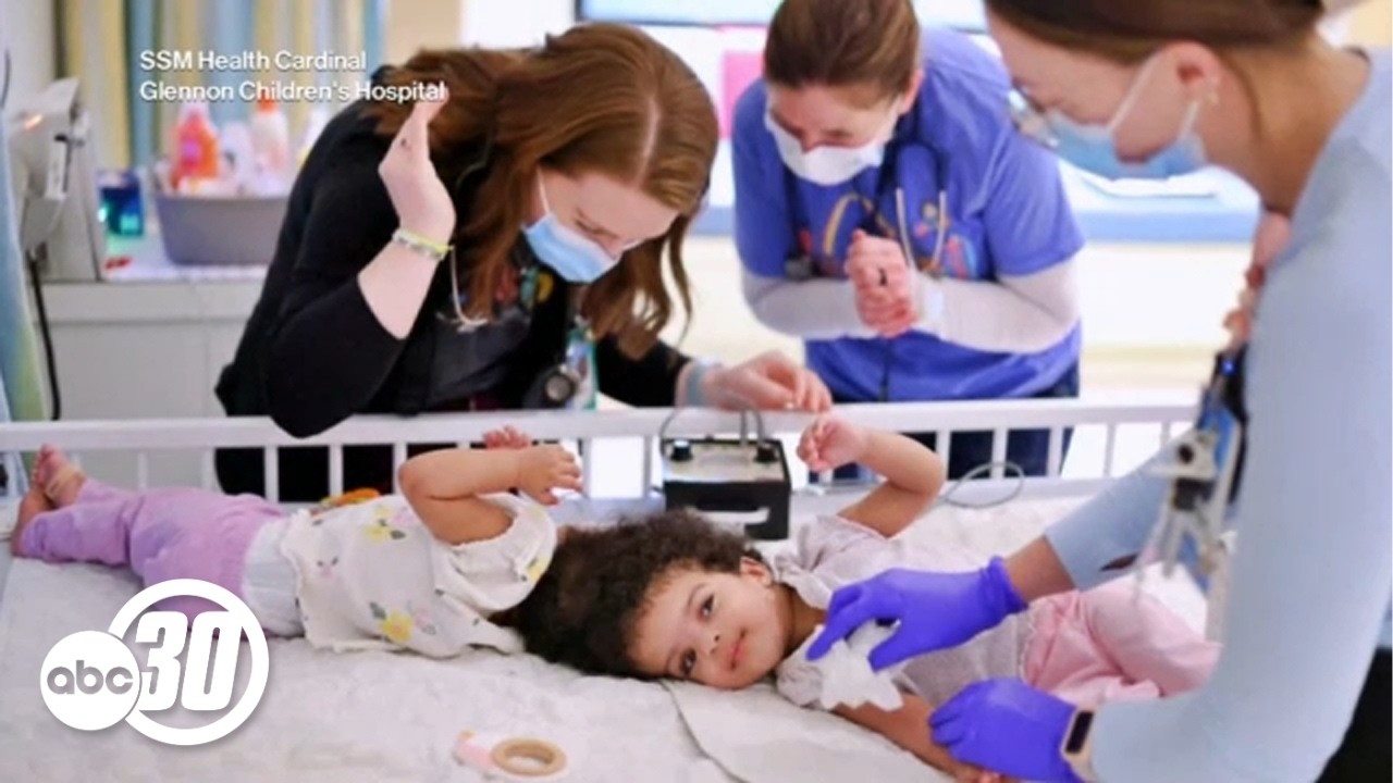 Twin sisters conjoined at head underwent successful separation surgery