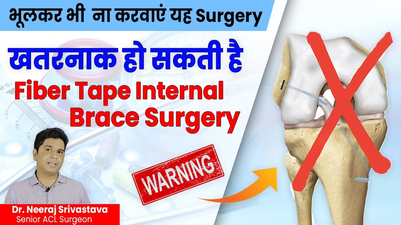 भूलकर भी ना करवाएं Fiber Tape Internal Brace Surgery l Fiber Tape Surgical Alternatives