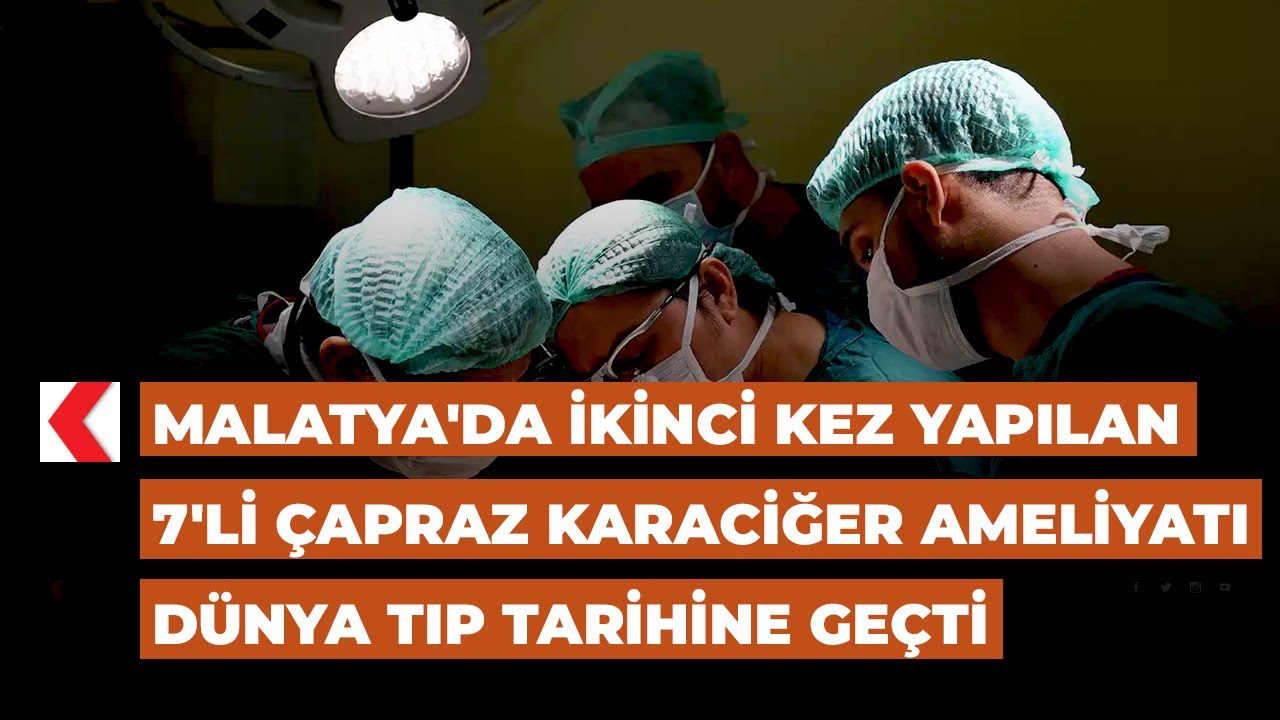 Malatya'da ikinci kez yapılan 7'li çapraz karaciğer ameliyatı dünya tıp tarihine geçti