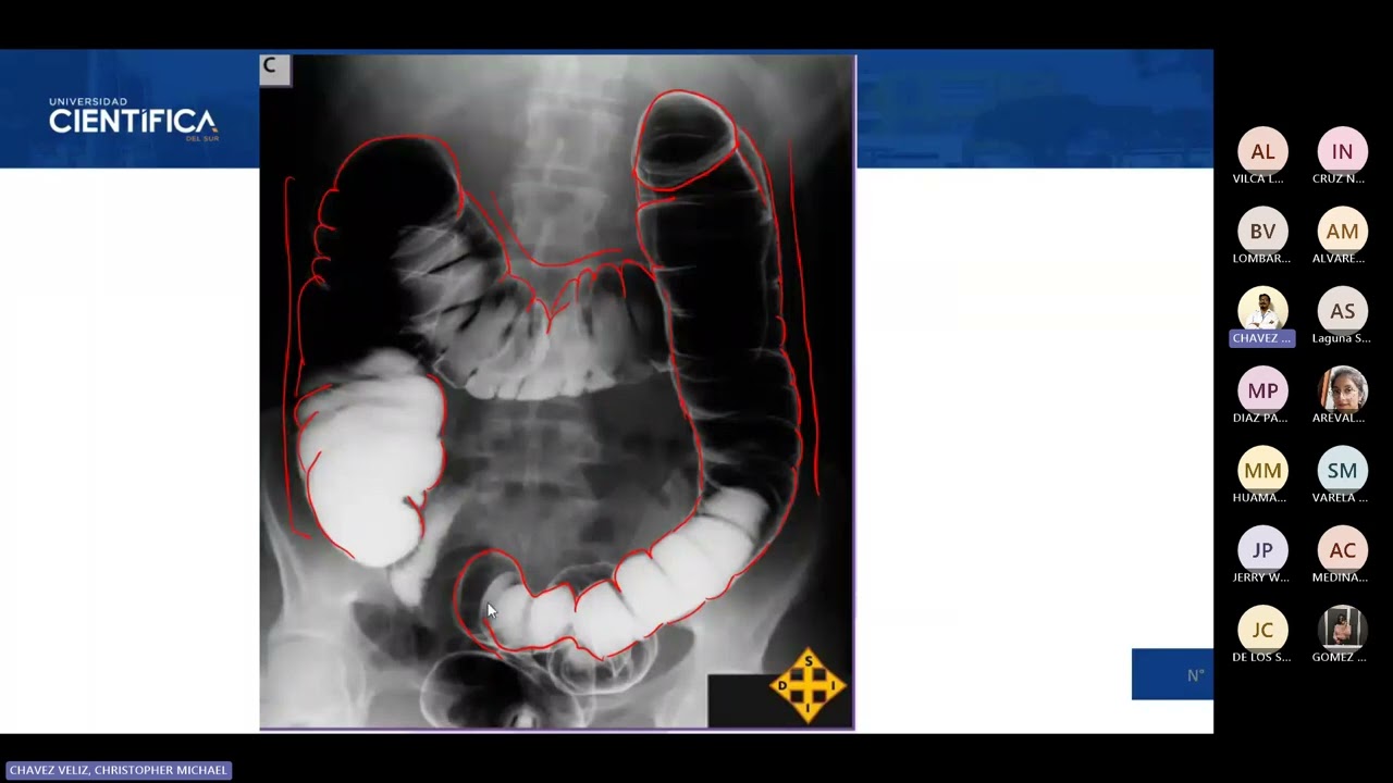 04) TUTORÍA DE ANATOMÍA DE MORFO 3 20260