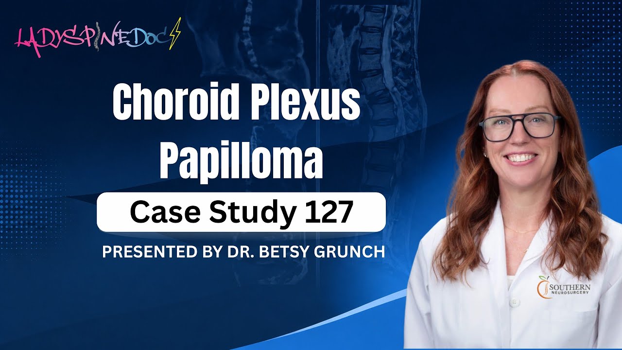 Case study 127 | Choroid Plexus Papilloma | explained by Dr. Grunch | pediatric brain tumor