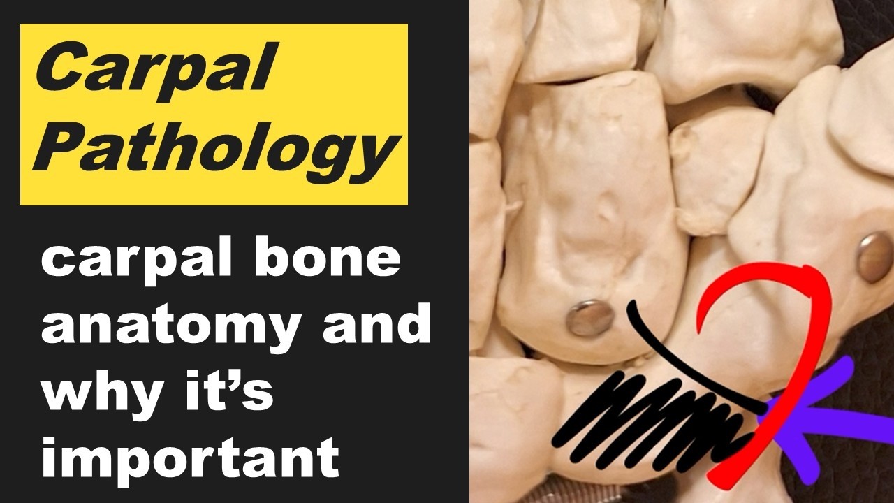 Carpal anatomy and pathology: bones, fractures and red flags