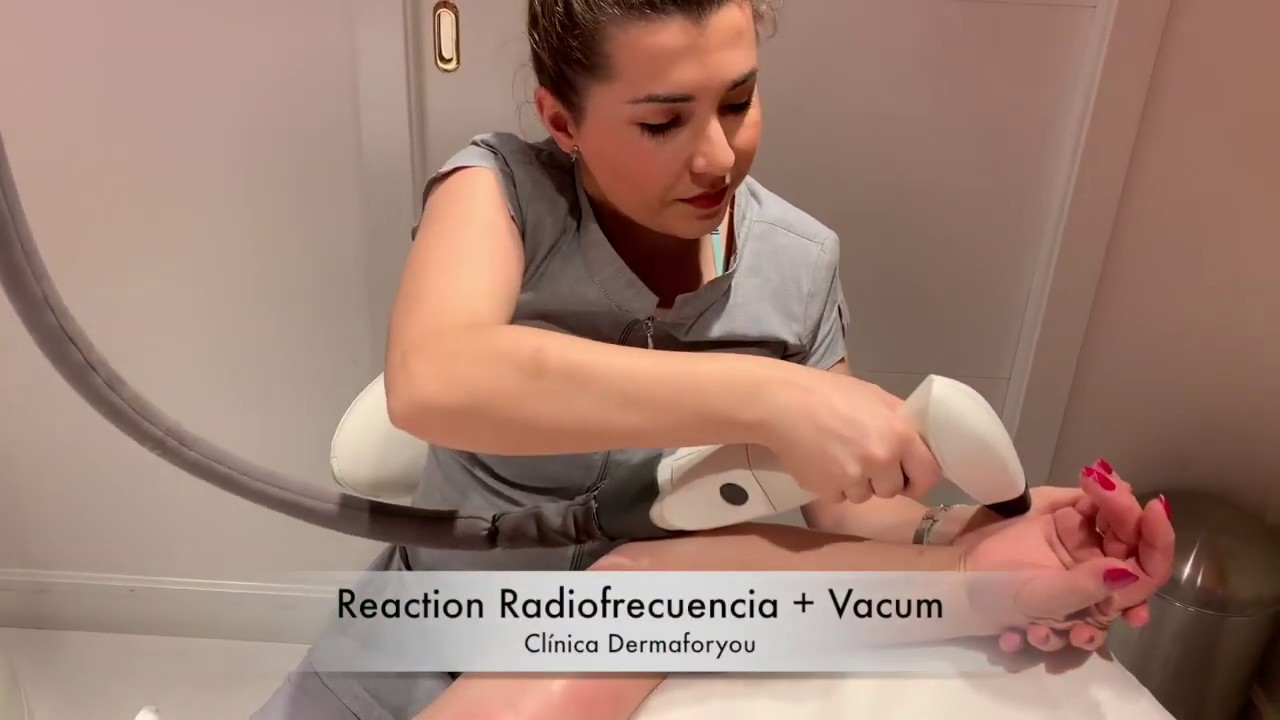 Reaction Radiofrecuencia + Vacum | Dermaforyou by Dra Carmen Galera