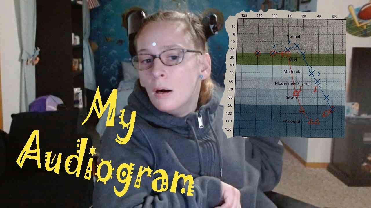 What Can I Actually HEAR? My Latest Audiogram