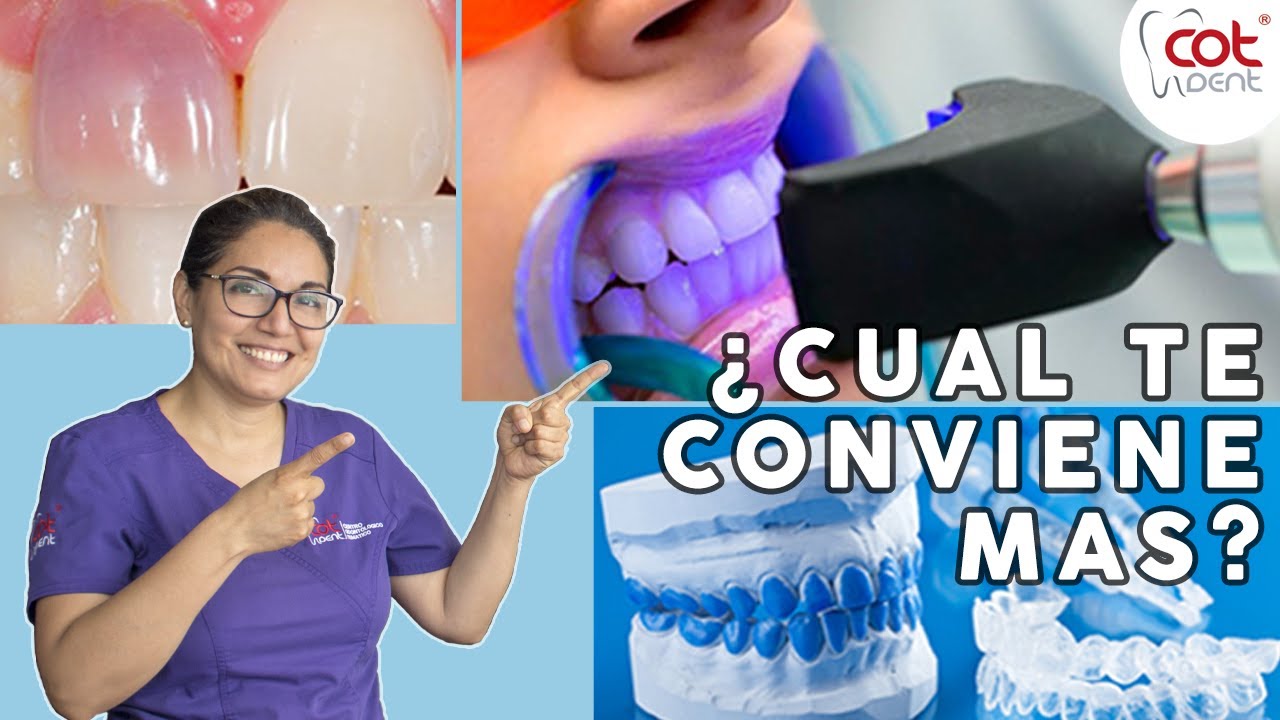 ¿Qué Tipo de Blanqueamiento Dental Deberías Hacerte?