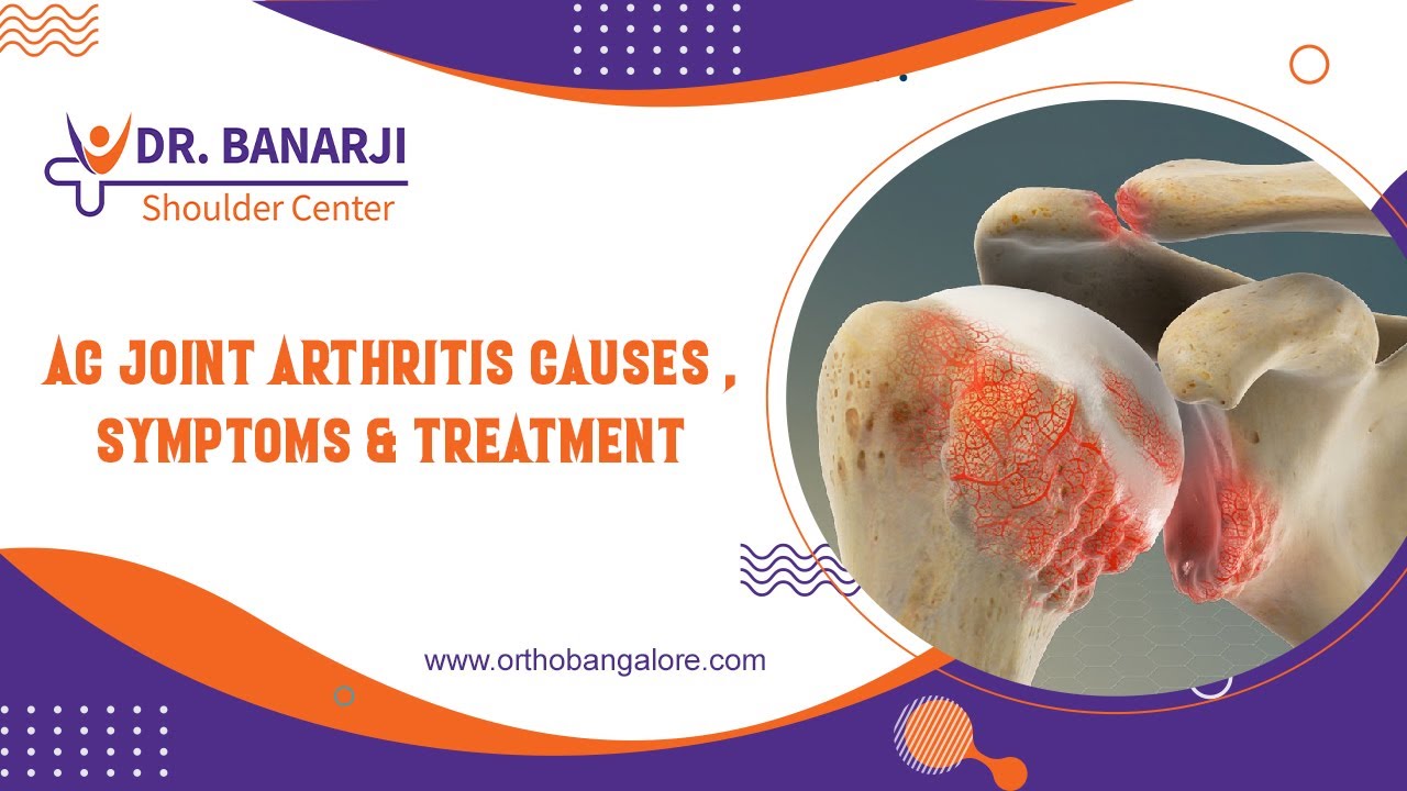 AC Joint Arthritis: Causes, Symptoms, and Treatment @ Dr. Banarji Shoulder Center.