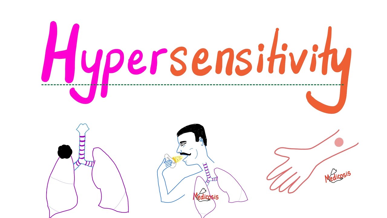 Hypersensitivity Reactions (Type I, II, III, IV HSN) - Allergy - Most Comprehensive Explanation!