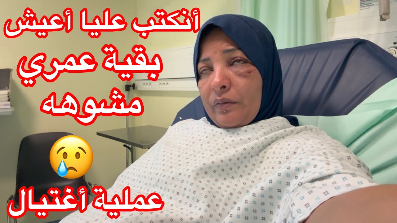 أنكتب عليا أعيش بقية عمري مشوهه😢بعد عملية الاغتيال اللي أتعرضت لها 😢😢