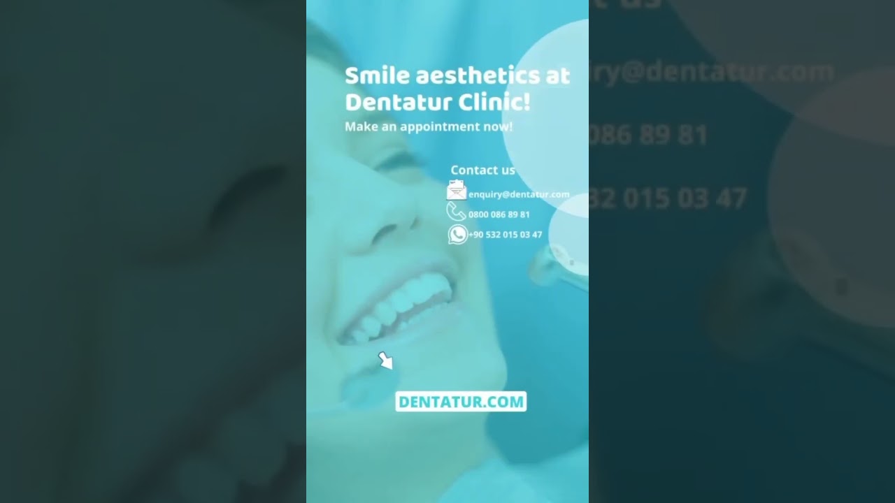 Laminate veneers at Dentatur in Turkey - best decision for your smile