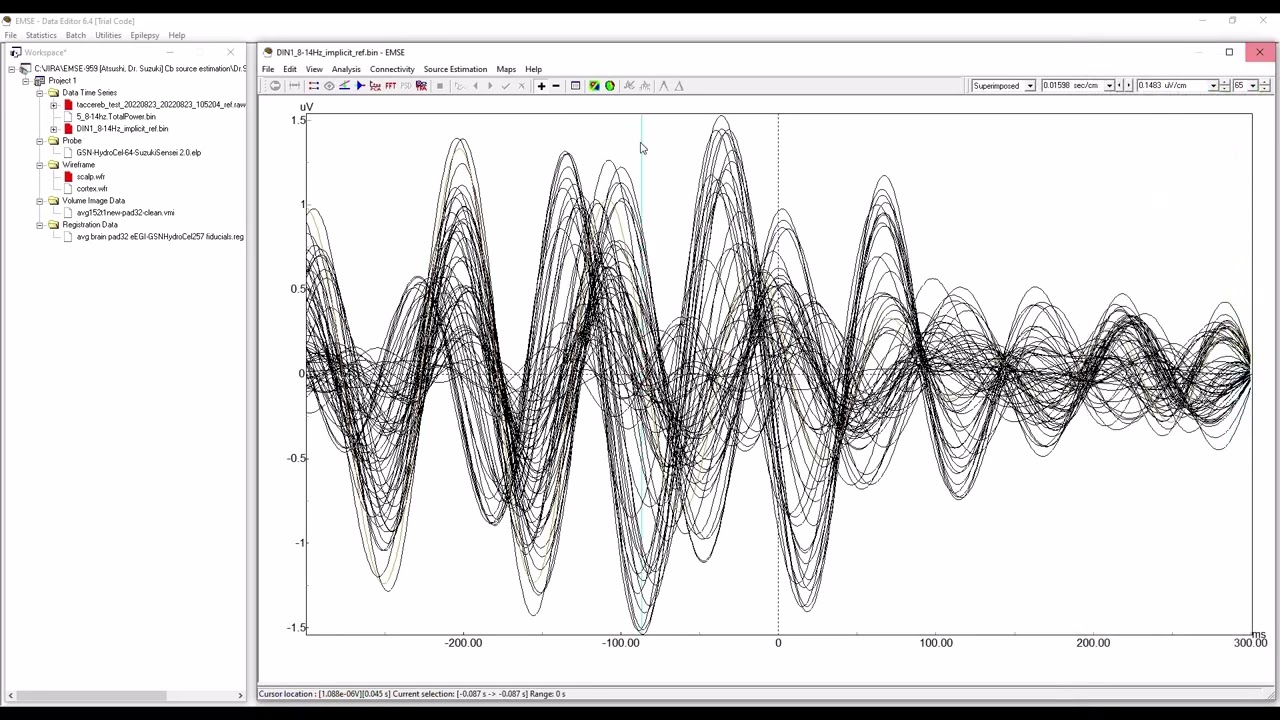EMSE   LORETA analysis of cerebellar activation during finger movements