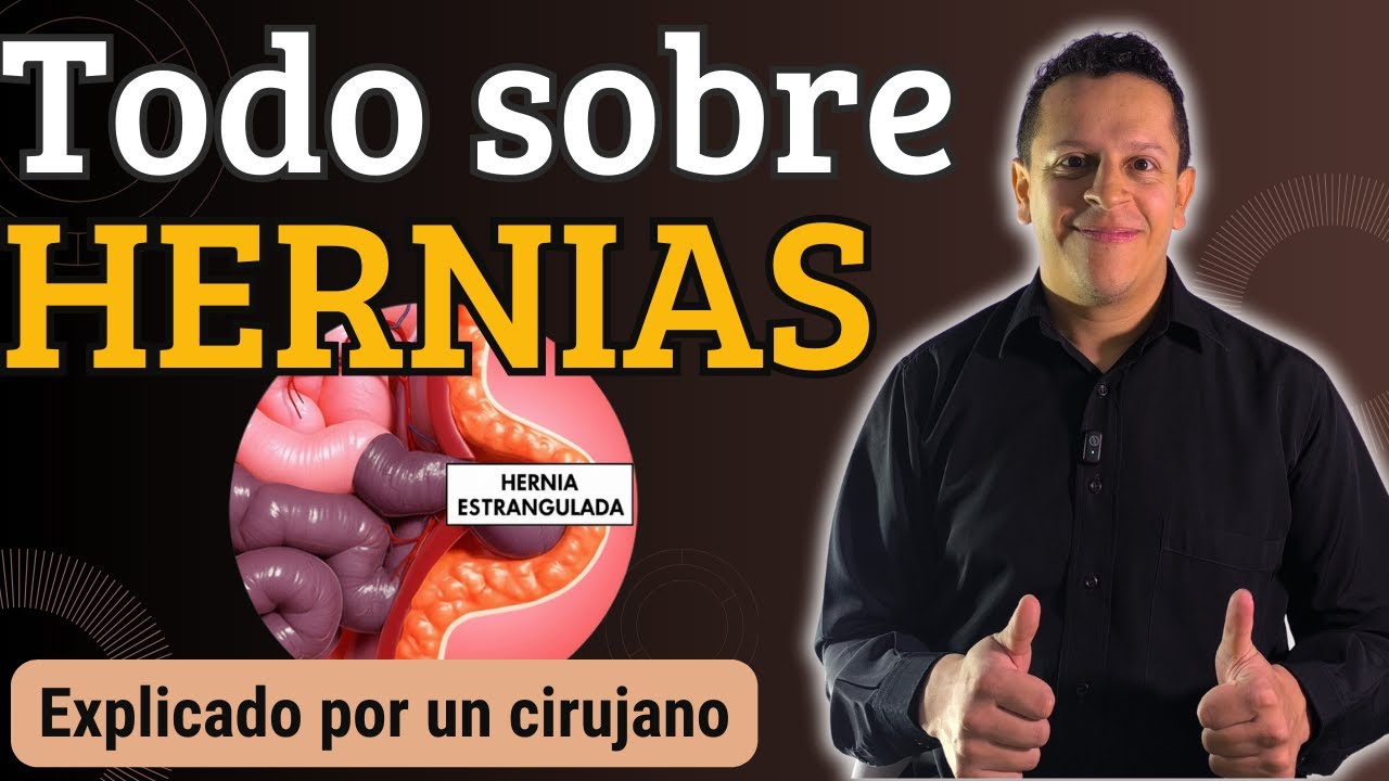 ¿Tienes una hernia abdominal? | Lo que debes saber y qué hacer