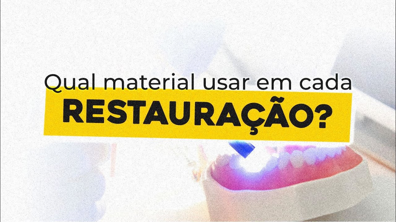 Qual materia usar em cada restauracao | DENTÍSTICA