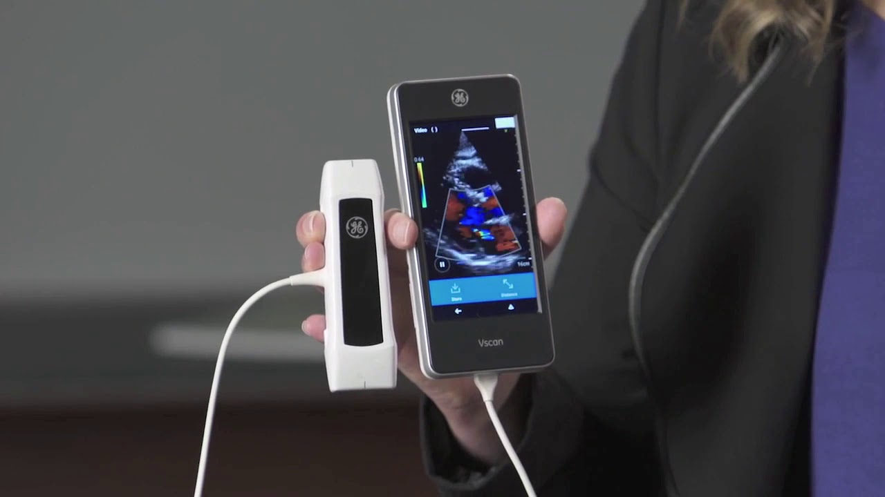 GE Vscan Extend Ultrasound - General Overview
