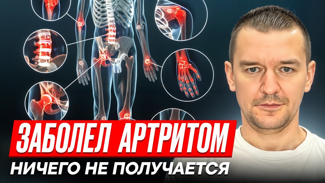Заболел артритом, ничего не получается