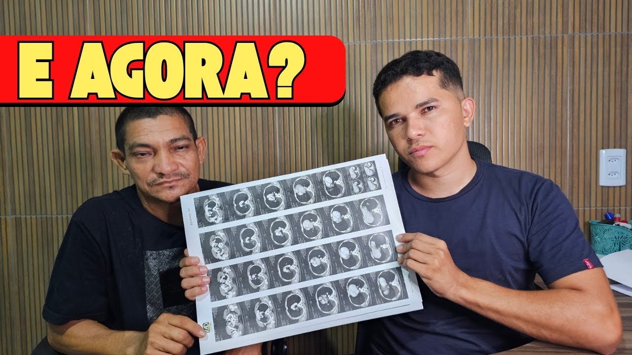 SEU HILTON: EXAMES INDICAM INTERNAÇÃO URGENTE💔