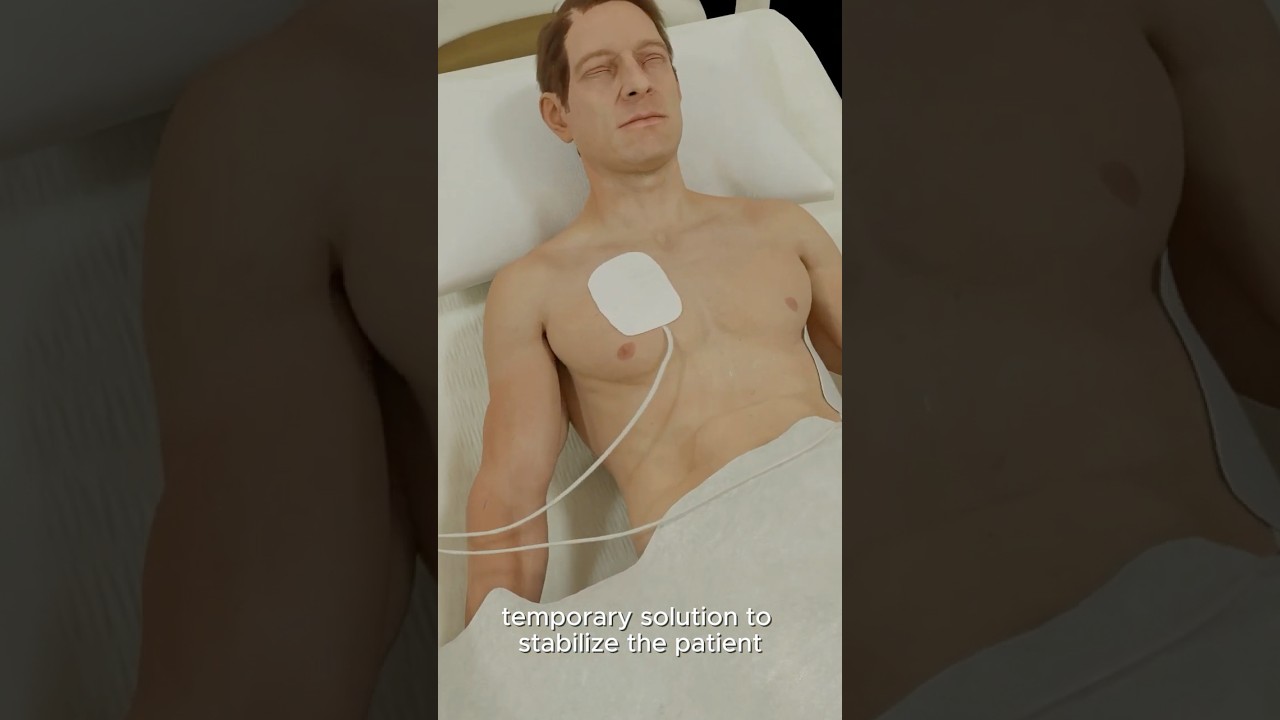 Why Transcutaneous Pacing Saves Lives in Seconds (3D Visual)