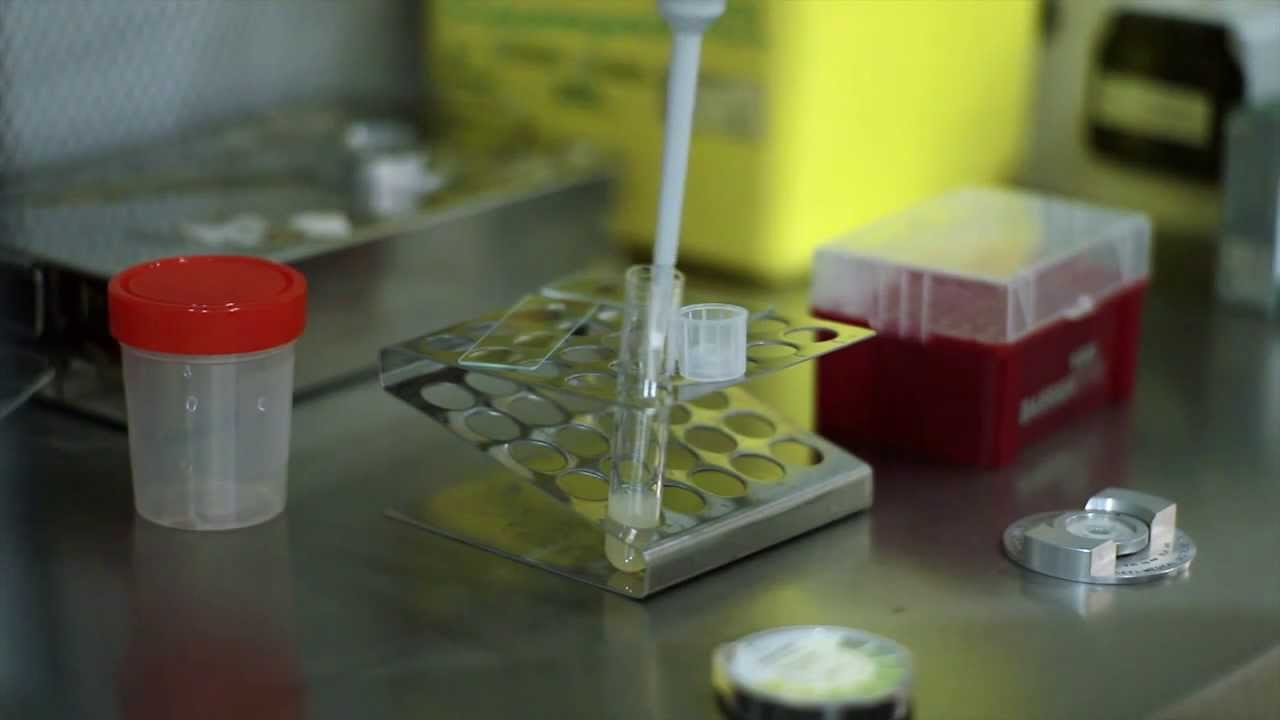 IVI Fertilit&eacute; - Ins&eacute;mination artificielle (UE, 2014)