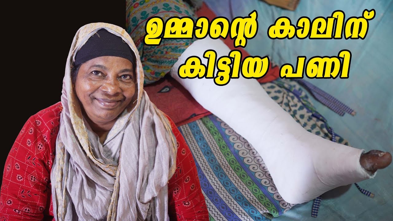 ഉമ്മാന്റെ കാലിന് കിട്ടിയ പണി | Mother's broken leg journey