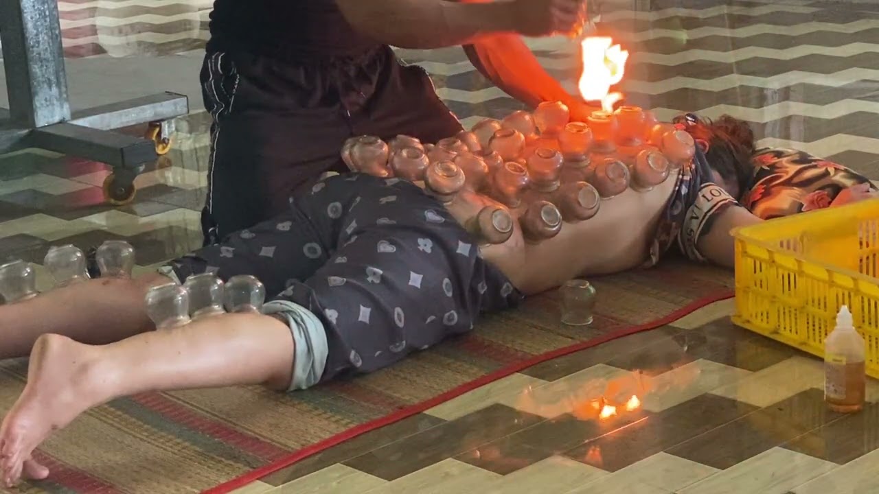 Cạo giác cho mẹ đơn u 43,