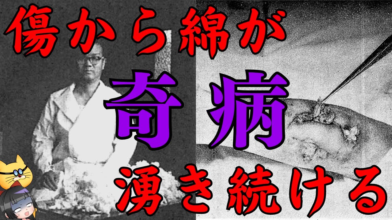 【綿ふき病】人体から植物が生える病