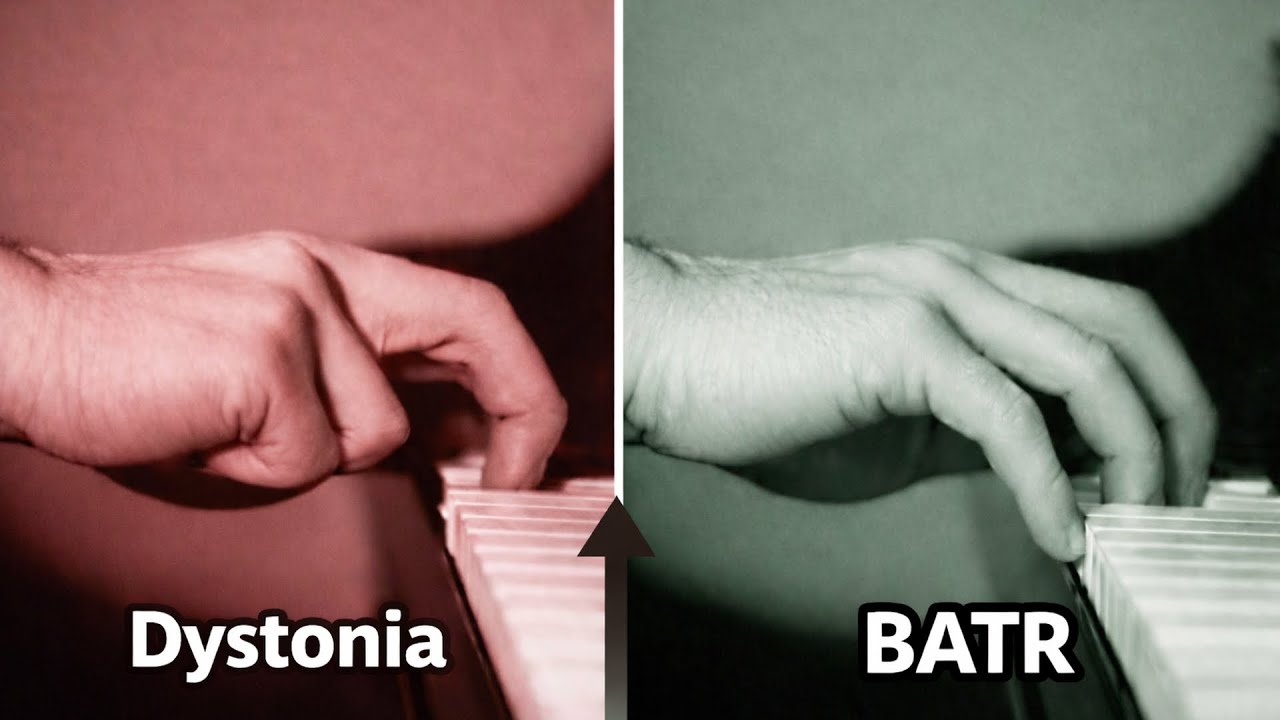 The Cure for Dystonia | Part 3