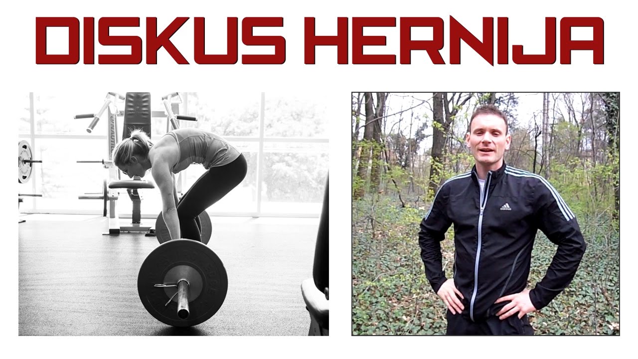 POVREDE LEĐA - DISKUS HERNIJA