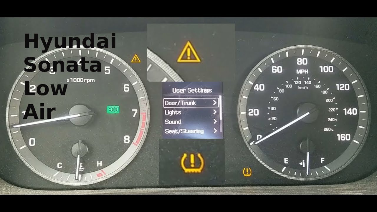 2015 Hyundai Sonata, контрольная лампа восклицательного знака