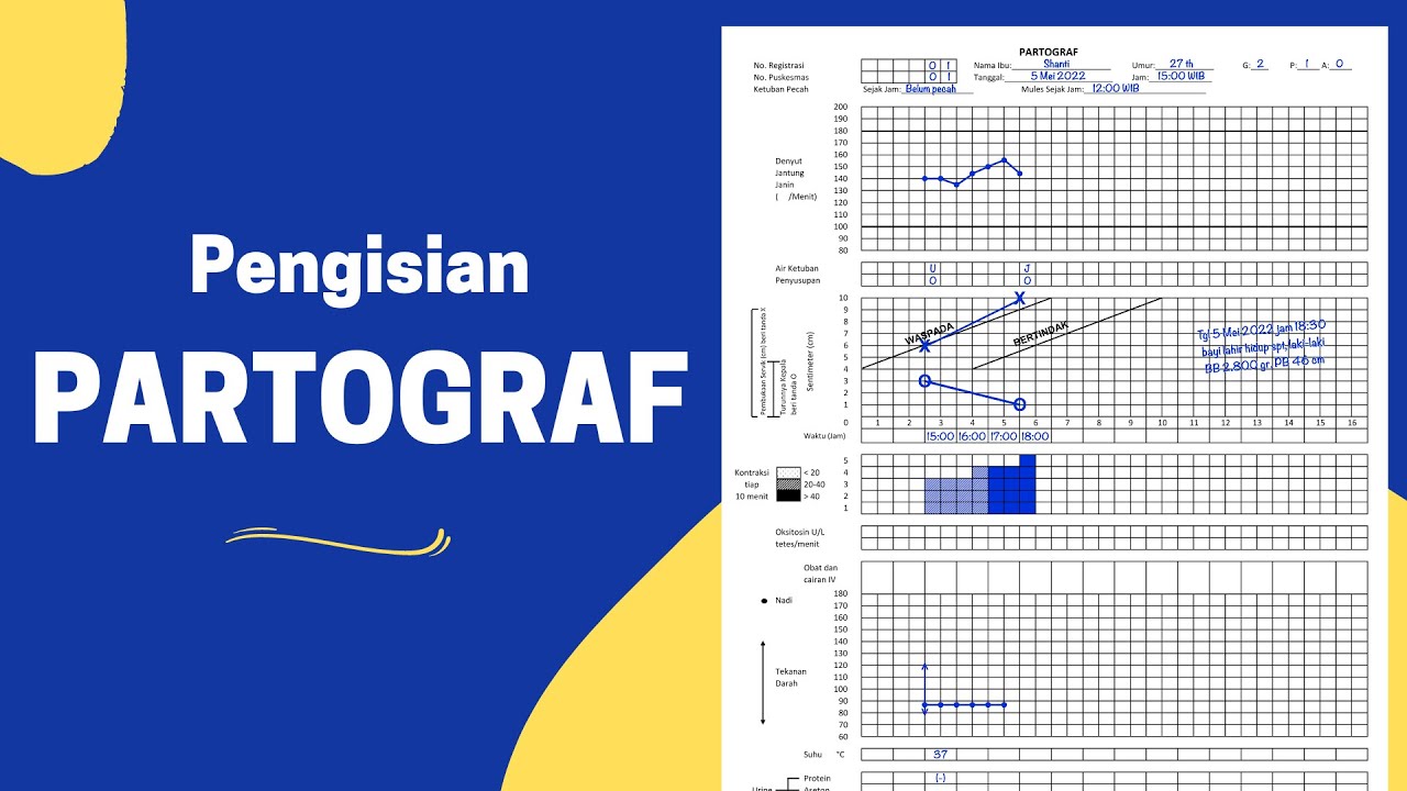 Pengisian Lembar Partograf dan Contoh Pengerjaan Soal Partograf