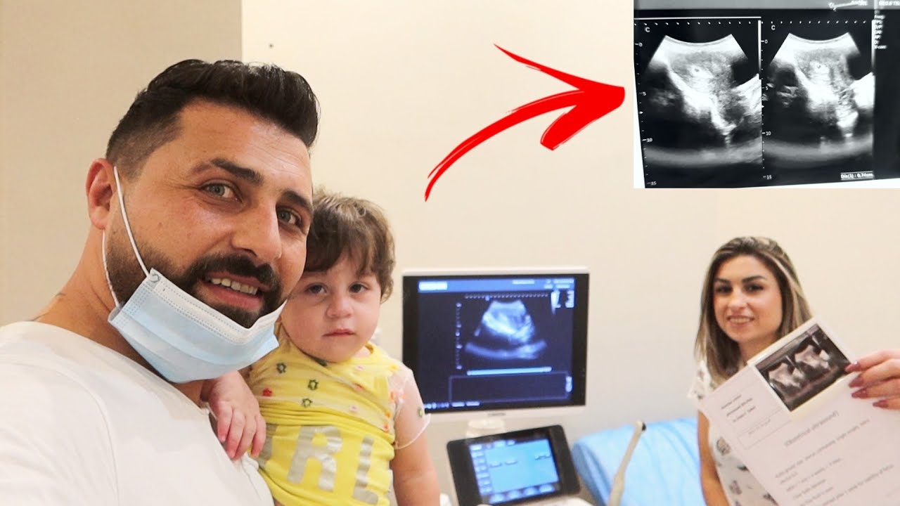أول مرة نشوف البيبي الجديد🤰🏼رح يكون حمل ننوش صعب !!😢
